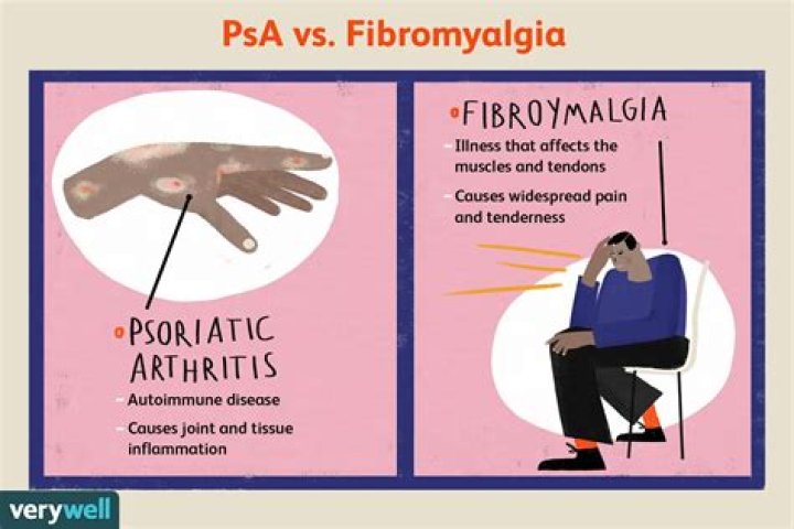 Are fibromyalgia and psoriatic arthritis related?