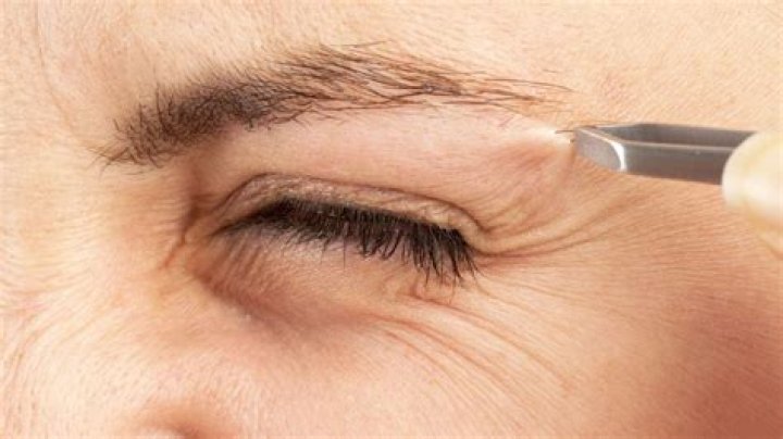 Can I pluck my dog's whiskers?