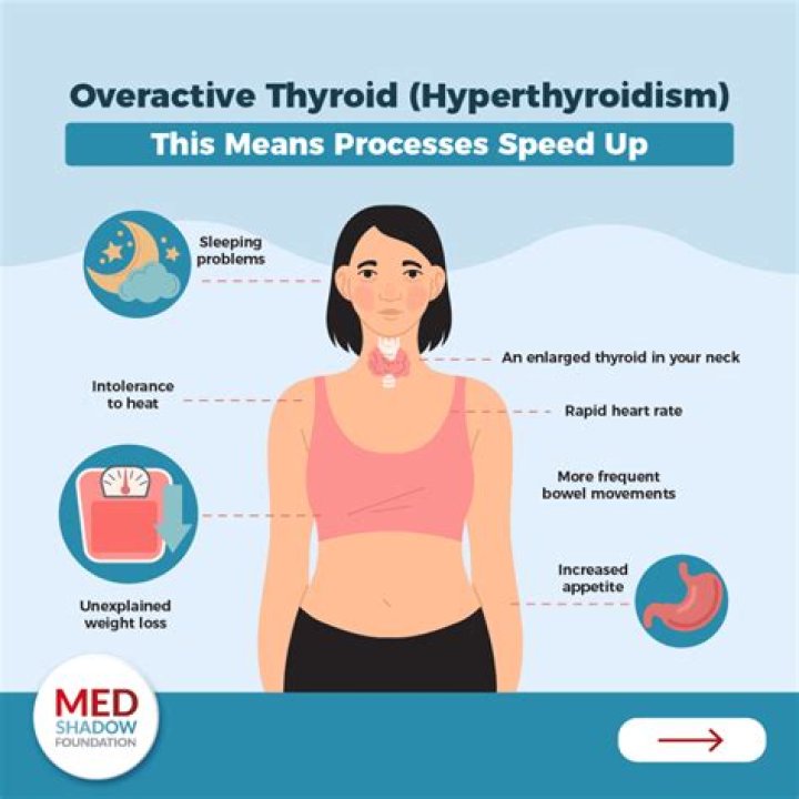 Can thyroid cause palpitations?