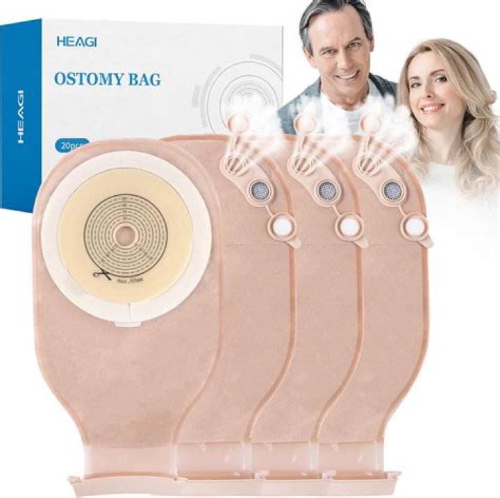 Can you get a blue badge if you have a colostomy bag?