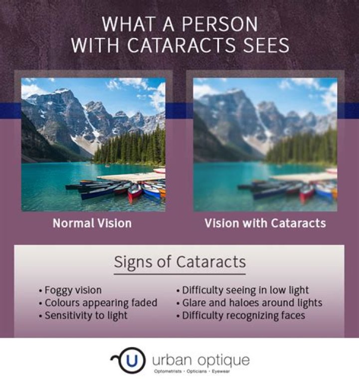 Can you see a cataract in the mirror?