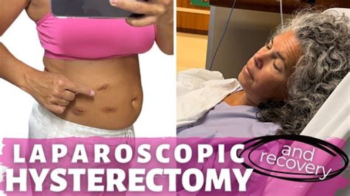Do you get a pooch after hysterectomy?