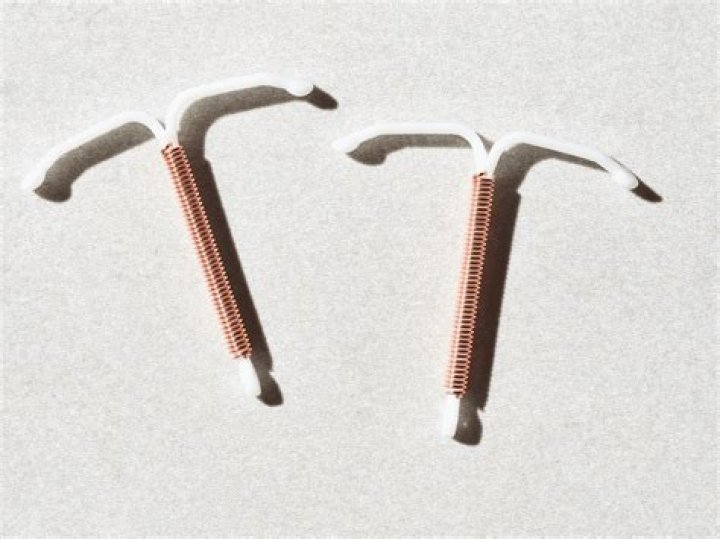Does copper IUD cause acne?