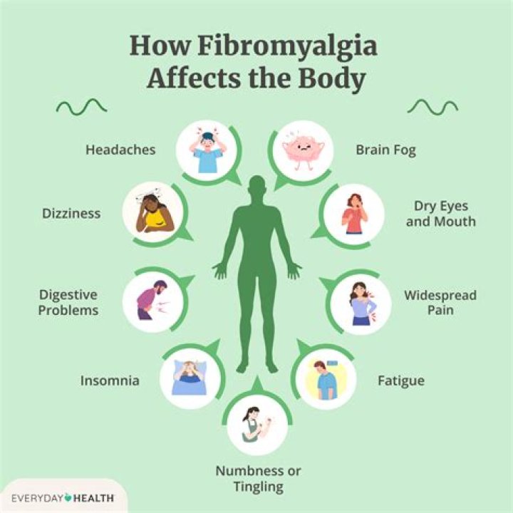 Does fibromyalgia give you headaches?