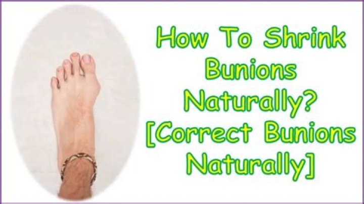 How can I shrink my feet naturally?