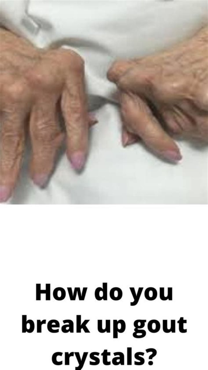 How do you break up gout crystals?
