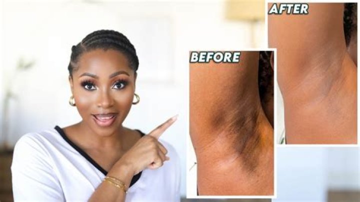How do you keep your armpits from getting white when tanning?