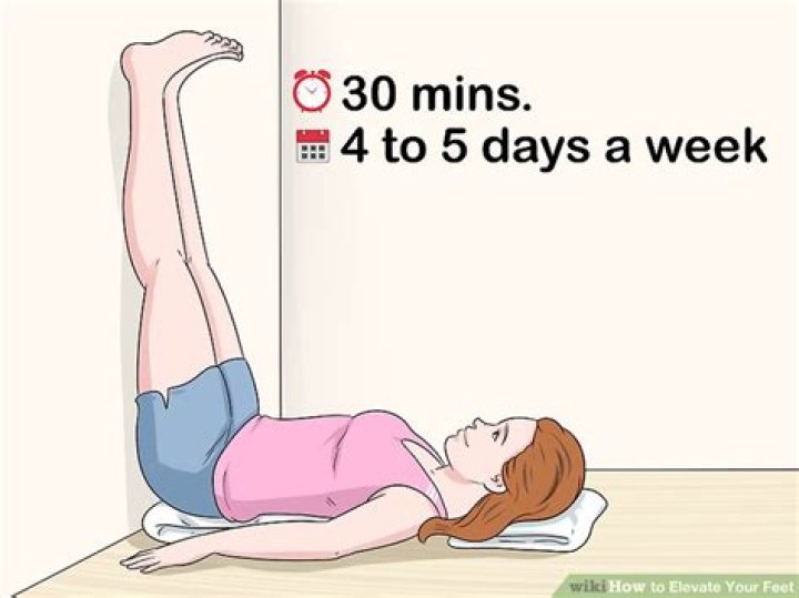 How long should you elevate your legs?