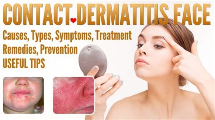 How long until contact dermatitis goes away?
