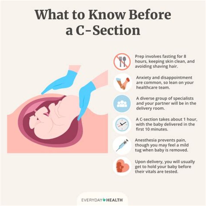 Is glue or staples better for C-section?