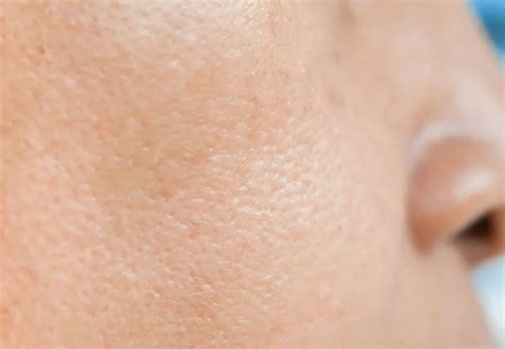 Is it possible to shrink pores?