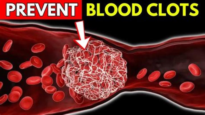 Is stretching good for blood clots?