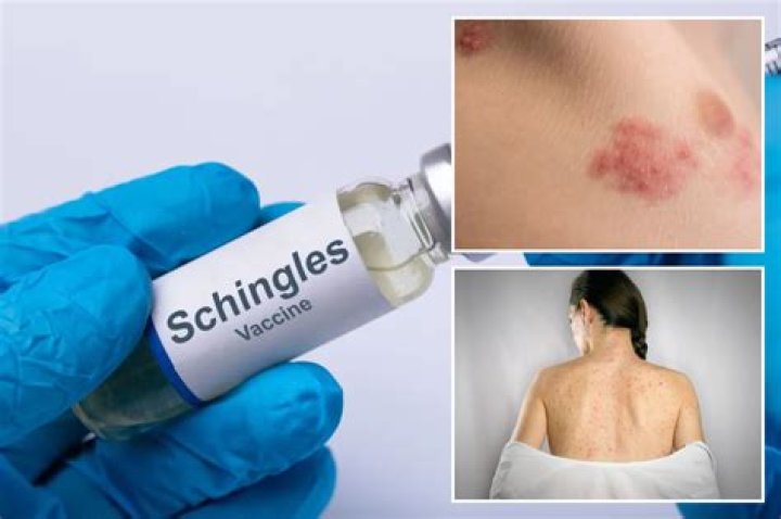 Should someone with autoimmune disease get shingles vaccine?