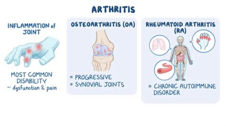 What's the difference between osteoarthritis and rheumatoid arthritis?