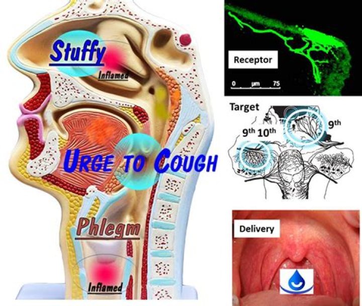 What are the stinky balls I cough up?
