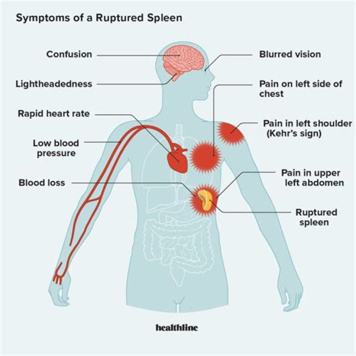 What are the symptoms of air in a water system?