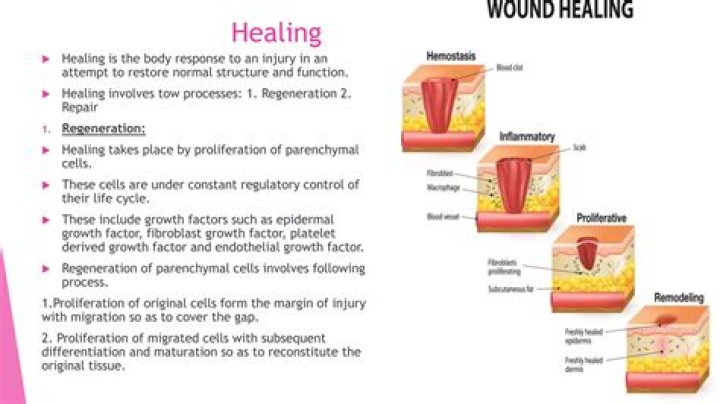 What can delay wound healing?