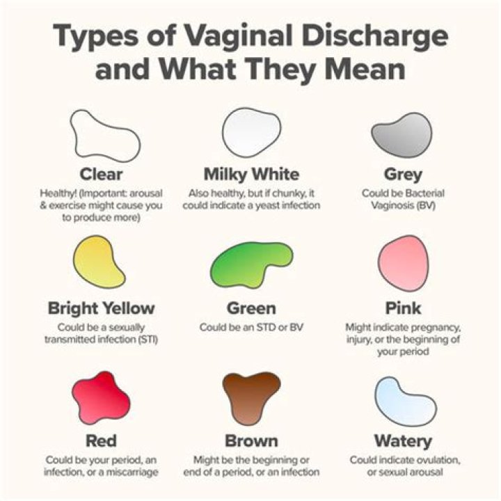 What color is healthy discharge?