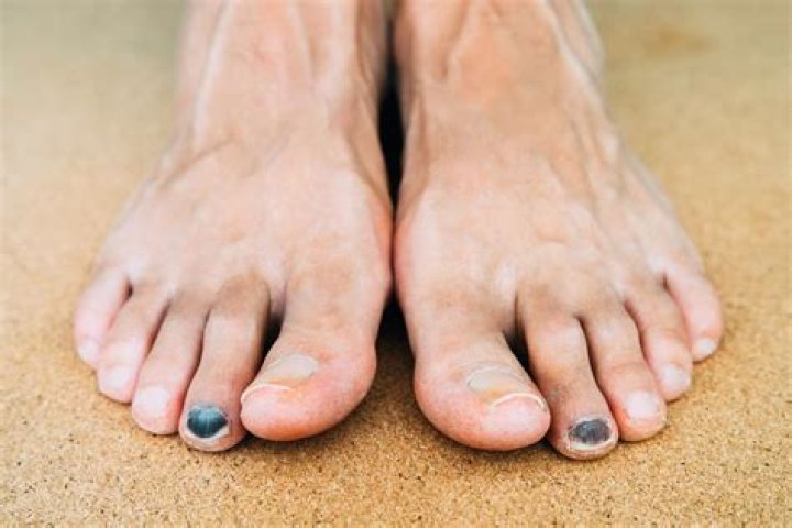 What does black painted toenails mean?