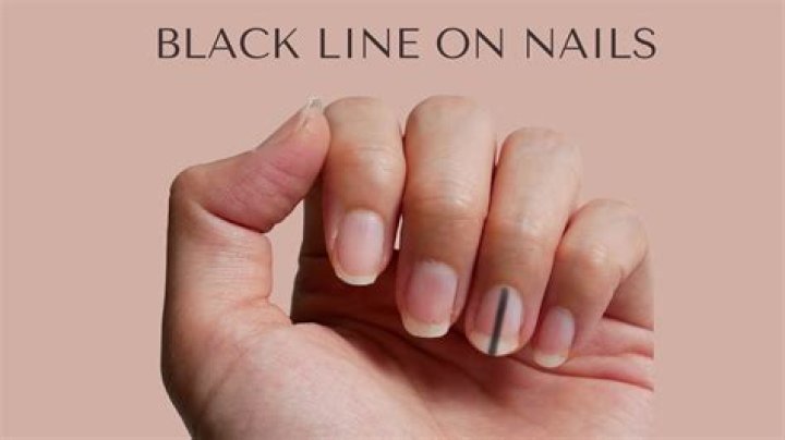 What does it mean when a guy tells you to get white nails?