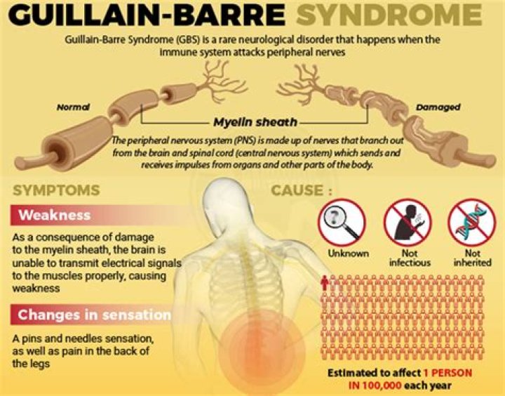 What happens if Guillain Barre goes untreated?