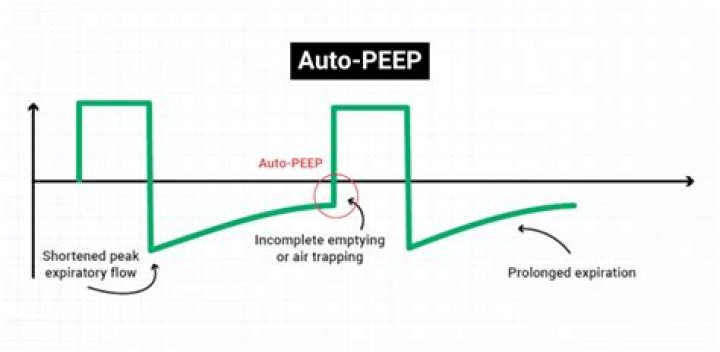 What is auto peeping?