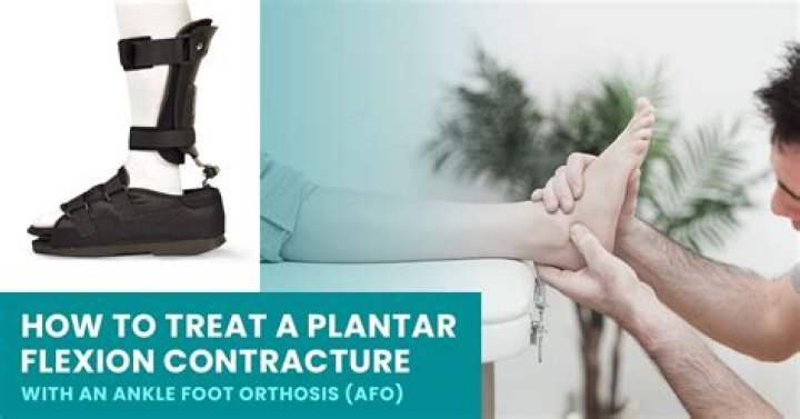 What is plantar flexion contracture?