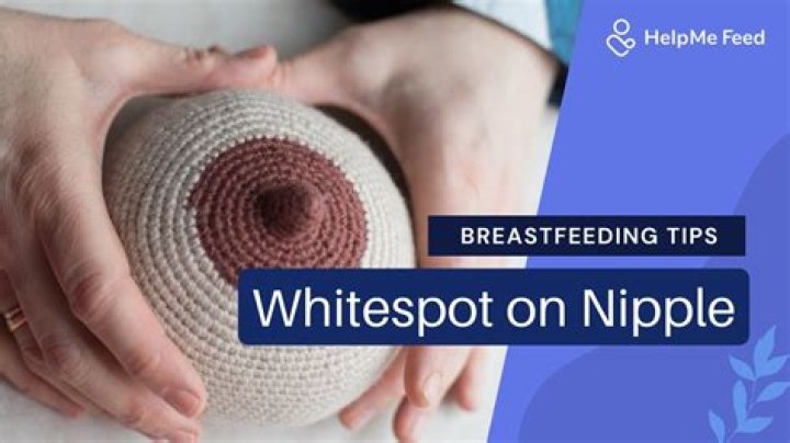 What is the white stuff in my nipples?