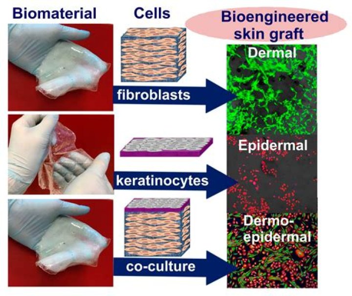 Why is my skin graft bumpy?