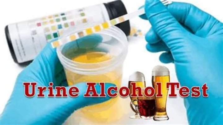 Will 0.5 alcohol show up in urine?